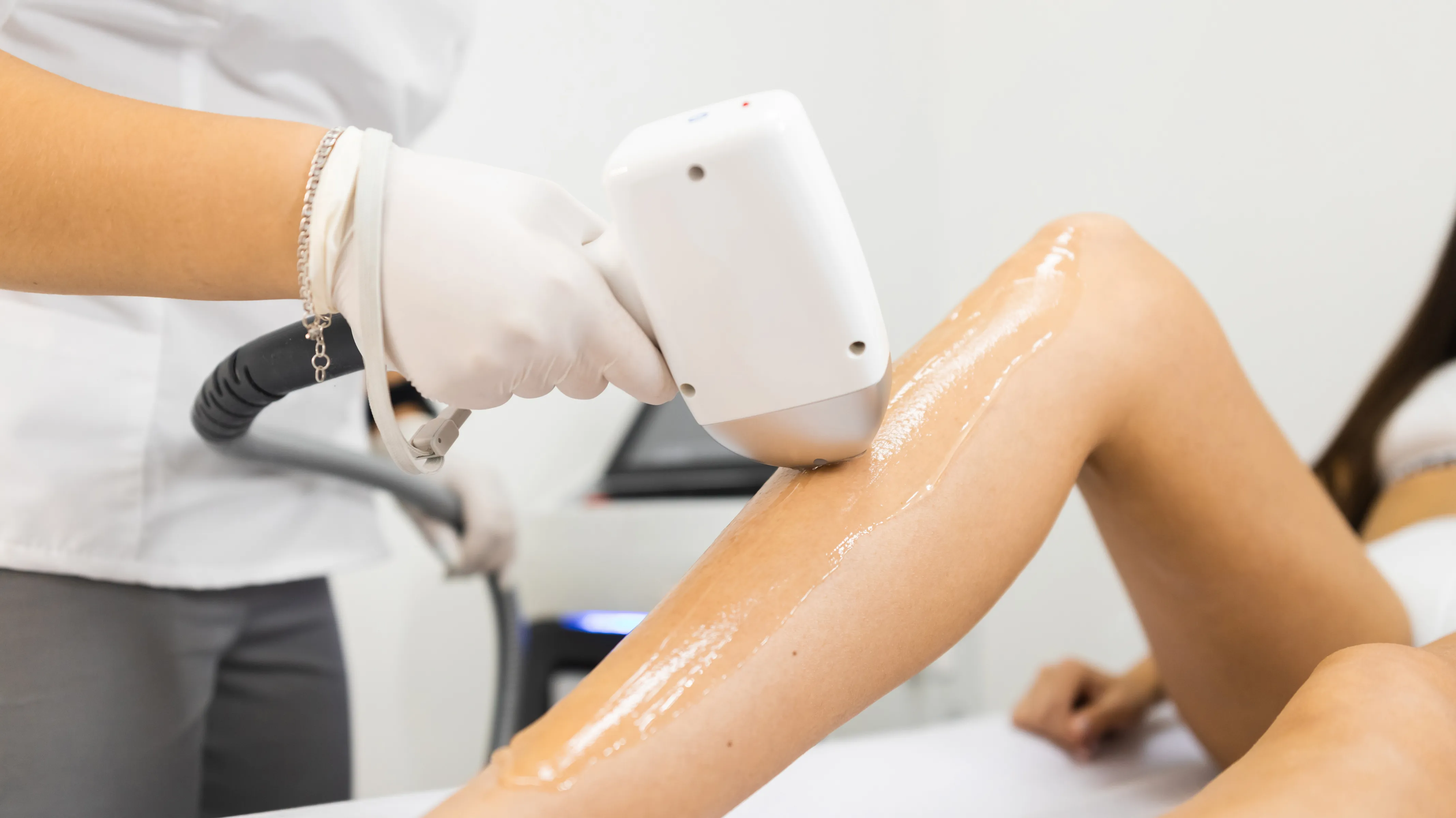 Diodenlaser Haarentfernung